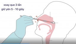 Test nhanh COVID-19: Việc cần làm để tránh dương tính giả, bao lâu nên test nhanh một lần?