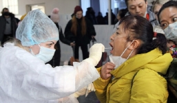 3 dấu hiệu cơ bản để biết bị cúm thường hay Covid-19