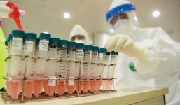Bộ Y tế nhập 200.000 test xét nghiệm nhanh Covid-19 của Hàn Quốc