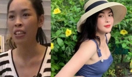 Cô gái được tài trợ 1 tỷ để 'đập mặt xây lại' giờ ra sao?