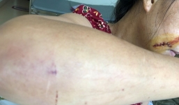 Người phụ nữ U50 bị người tình đuổi đánh dã man giữa sân nhà