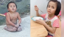 Em bé Mường Lát bị liệt chân sau 3 năm được nhận nuôi giờ ra sao?