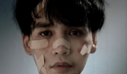 Thầy Erik để lộ khuôn mặt dán urgo chằng chịt, fan chờ đợi điều bất ngờ