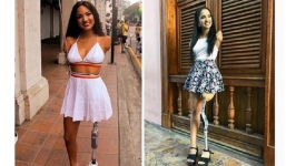 Thiếu nữ xinh đẹp làm điều phi thường dù mất 2 tay và 1 chân 