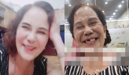 Cô dâu 65 tuổi lộ ảnh làm lại răng hậu ồn ào bị chồng trẻ 'đi đường quyền'