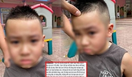 Phụ huynh đánh sưng mặt trẻ mẫu giáo vì cào xước mí mắt con mình