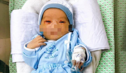 Bác sĩ dồn lực cứu bé sơ sinh bị bỏ rơi dưới hố ga nghi bị nhiễm trùng máu