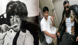 'Cậu bé người vượn' giờ ra sao sau 40 năm bị ghẻ lạnh vì khác người