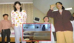 Chuyện ly kỳ về cô gái 18 tuổi cao 2,5m và sự ra đi đầy cao thượng