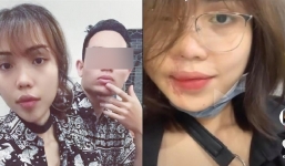 Cô gái Đà Nẵng bị chồng tạt axit, gương mặt phục hồi đáng kinh ngạc