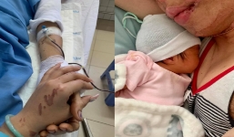 Chàng Việt kiều Canada sau hơn 1 năm bị kẻ lạ mặt cắt gân, tạt axit giờ ra sao?