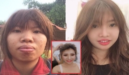 Cô gái bị gọi là Thị Nở sau 4 năm đổi đời bất ngờ thông báo lấy chồng