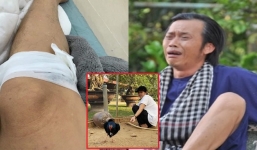 Hoài Linh gặp tai nạn hy hữu nhưng vẫn hóm hỉnh tếu táo 'không chấp'
