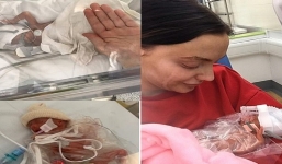 Em bé 9 lạng và hành trình giành giật sự sống phi thường trong túi nilon