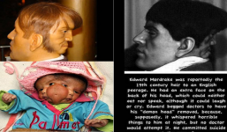 Người đàn ông có khuôn mặt đằng sau gáy và sự thật được vén màn