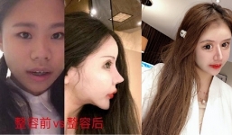 Cận cảnh nhan sắc 'dao kéo' 70 lần của 10x Trung Quốc, càng sửa càng sợ