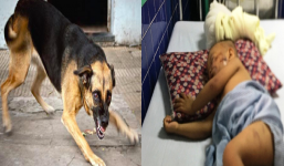 Xót xa bé 2 tuổi bị chó becgie 38kg cắn vào đầu đến nhập viện, cấp cứu khẩn trong đêm