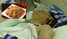 Ăn lại đồ để tủ 2 ngày, người đàn ông nhập viện cấp cứu đến 'thập tử nhất sinh'