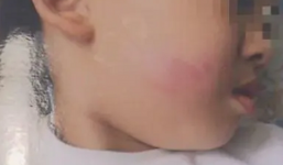 Cô giáo nói 'chỉ sờ nhẹ một cái vào má chứ không đánh', bố mẹ mãi mất con 