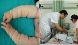 Bà chăm cháu ngấn nào ra ngấn nấy nhưng đi khám bác sĩ bảo bé phải cắt bỏ đôi chân