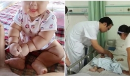Bà chăm cháu múp míp nhưng đi khám bác sĩ bảo phải cắt bỏ đôi chân