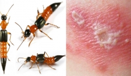 Dấu hiệu nhận biết kiến ba khoang cắn và cách chữa nhanh nhất