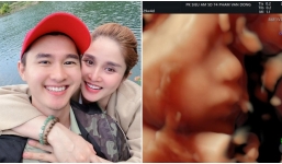 Vợ cũ Phan Thanh Bình hạnh phúc khoe ảnh siêu âm con sắp sinh, dân tình nhận ra ngay một chi tiết 'cực phẩm'