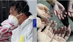 Đằng sau những bộ đồ bảo hộ bí bách dưới cái nóng gần 40 độ là bao trái tim nhiệt huyết và đầy dũng cảm