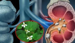 8 công dụng rau diếp cá: Tiên dược với nhan sắc, thần dược của hệ tiêu hóa