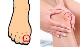 4 nốt ruồi 'bất chợt' có ở vị trí chân này có thể là điềm báo 'ăn lộc' phú quý, thịnh vượng đi lên