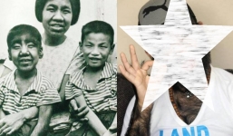 Cuộc sống ‘cậu bé người vượn’ toàn thân đầy lông giờ ra sao?