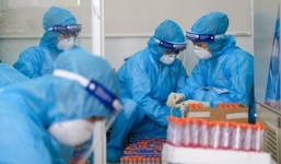 Trường hợp F0 điều trị Covid-19 tại nhà cần làm gì khi bị sốt?