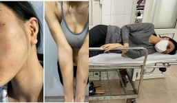 Siêu mẫu Khả Trang bị bạo hành, mẹ chồng nhắn: 'Làm thế là dại..., đánh thì đau nhưng xong lại khỏi'