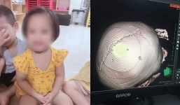 Vụ bé 3 tuổi bị bắn 9 cái đinh vào não: Mẹ bé đang mang thai, quyết tâm đi theo nhân tình