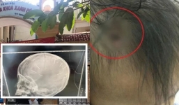 Thực hư tấm ảnh được cho là của bé gái 3 tuổi bị ‘bố dượng’ ghim 9 đinh vào đầu gây xôn xao MXH?