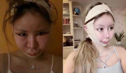 Hà Nội: Nữ sinh 22 tuổi tử vong sau khi hôn mê 2 tháng vì phẫu thuật thẩm mỹ