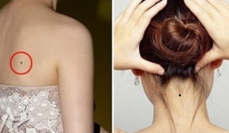 6 vị trí nốt ruồi vượng tướng: Phải tu 9 kiếp mới có, tẩy đi là mất ngay phúc phần