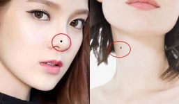 4 vị trí nốt ruồi của người phụ nữ dễ được gả vào hào môn, lấy chồng là viên mãn