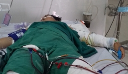 Người vợ bị chồng tẩm xăng đốt vì ghen tuông đã tử vong