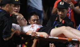 Nữ CĐV đổ máu, phải nhập viện khẩn cấp vì pháo sáng tại Hàng Đẫy