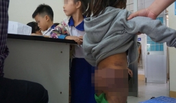 Thông tin mới nhất vụ 4 học sinh bị người thân bạo hành ở Cà Mau