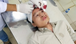 Kiểm lâm viên bị nhóm côn đồ xông vào trụ sở hành hung, đánh nhập viện