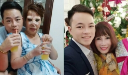 Cô dâu Thu Sao tiếp tục đụng ‘dao kéo’, gương mặt băng bó khó nhận ra