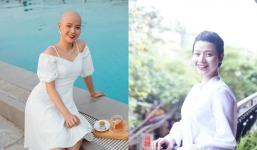Nữ sinh Ngoại thương mắc bệnh ung thư vú tái xuất, ngoại hình xinh đẹp gây ngỡ ngàng