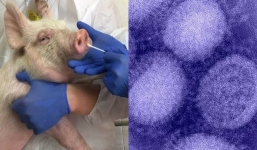 Trung Quốc phát hiện loại virus cúm mới, có khả năng gây đại dịch