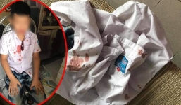 Thông tin mới nhất vụ bé lớp 1 bị bố của bạn đánh nhập viện