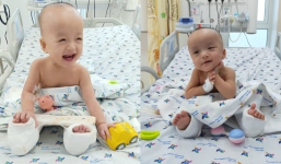 Xúc động hình ảnh 2 bé song sinh tự ngồi dậy chơi đùa, nũng nịu sau ca mổ tách thần kỳ