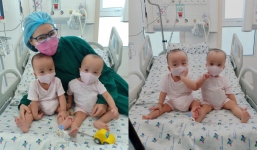 2 bé song sinh đã được tháo nẹp hoàn toàn, bắt đầu tập đi sau ca phẫu thuật lịch sử