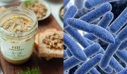 Botulinum trong pate Minh Chay là ‘chất độc khét tiếng’, mạnh gấp 10.000 lần Kali Xyanua