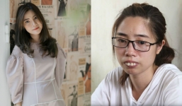 Cô gái bị miệt thị vì ngoại hình giống Thị Nở, ‘lột xác’ hoàn toàn sau 2 lần đại phẫu